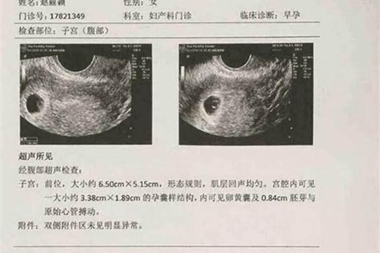 八字哪个命格最好