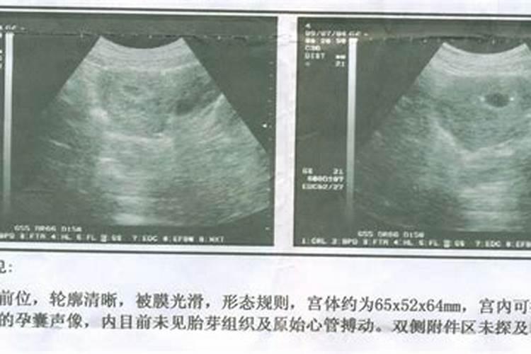 属鸡未来十年总体运势怎么样